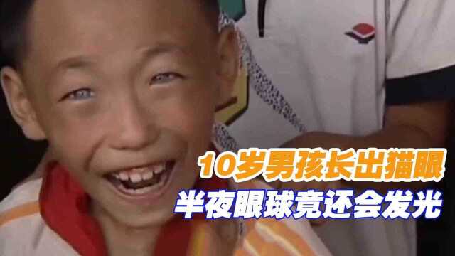 10岁男孩长出猫眼天生的蓝色眼睛晚上没有光也能看见东西