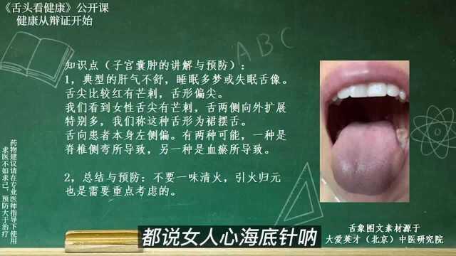 舌象分析:舌尖偏红有芒刺,心悸,失眠多梦,肝气不舒的舌象讲解