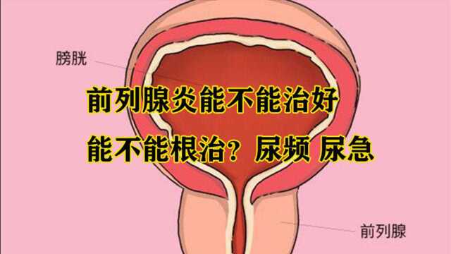 前列腺炎能不能治好,能不能根治?