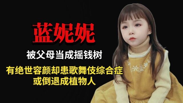 蓝妮妮:被父母当成摇钱树,有绝世容颜却患歌舞伎综合症,恐倒退成植物人