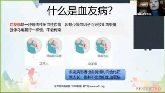 X59 儿童患者的治疗和日常须知 11月17日19:0020:00张娴老师直播视频