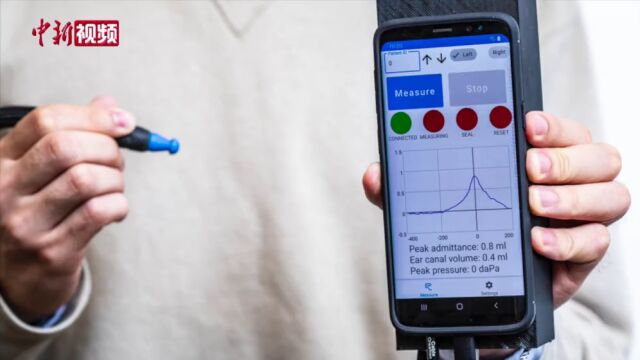 最新研究报告:可测试中耳功能的智能手机附件