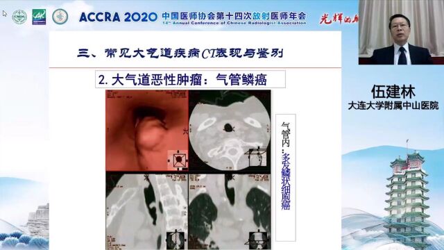 常见大气道病变的CT诊断与鉴别大连大学附属中山医院伍建林