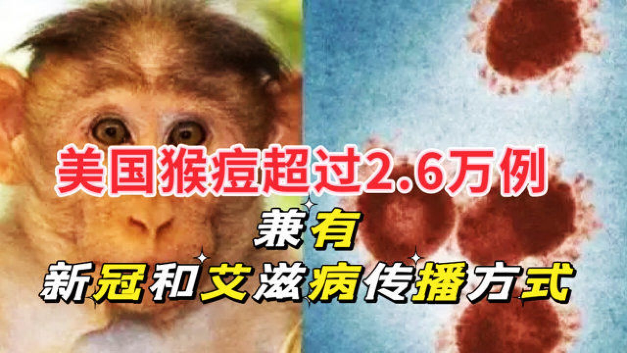 猴痘在美国超过2.6万例,稳居第一,兼有新冠和艾滋病的传播方式