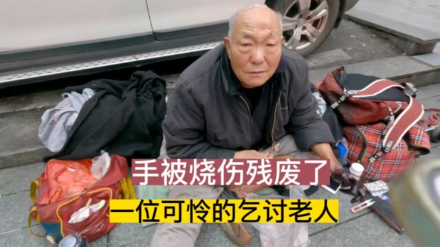 手被严重烧伤残废了,一位可怜的乞讨老人在长沙的街头