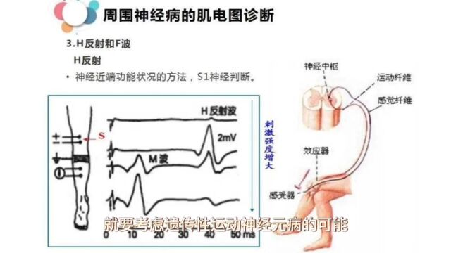 西医的副作用