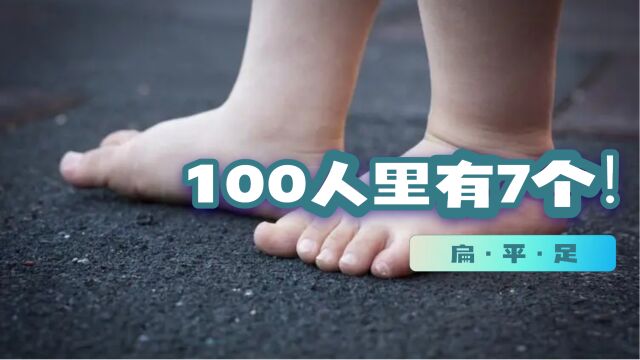 一定要注意:100人中竟然有7个扁平足!为什么孩子扁平足那么多?