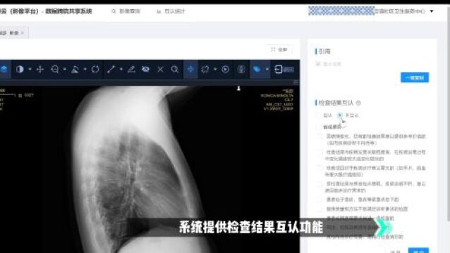 “云影像”来了!跨医院就诊看电子胶片,不用重复检查!