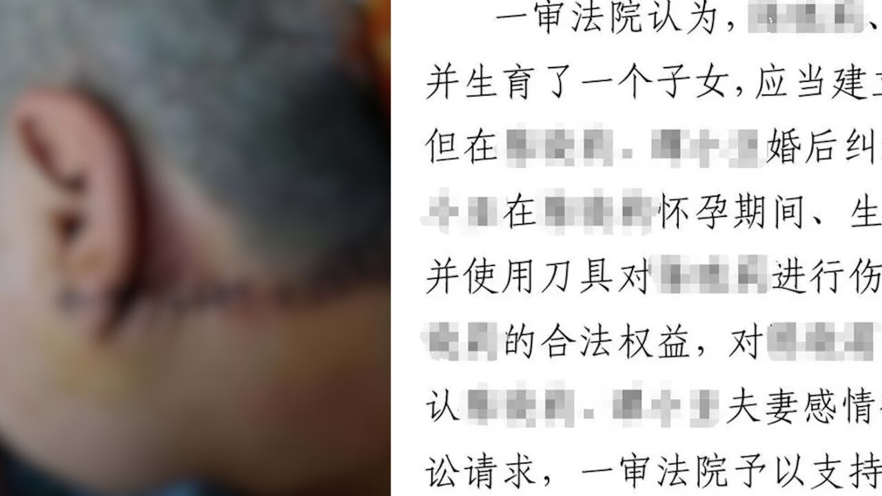 女子去前夫家收拾物品被对方持刀砍伤,最长伤口达25厘米,妇联:如需帮助会提供法律援助