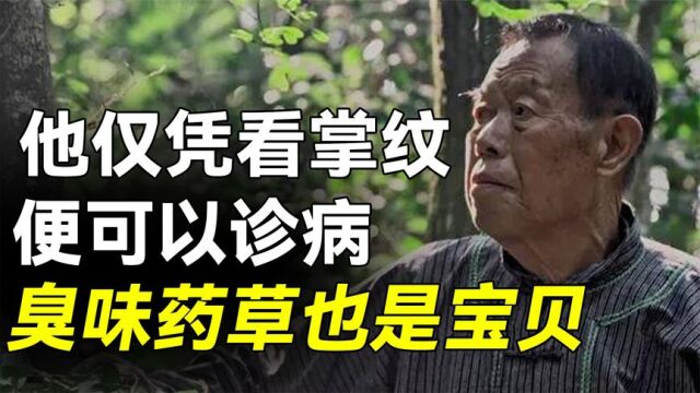 苗医仅凭看掌纹,就可以确定患者的病情,臭味药也是宝贝?