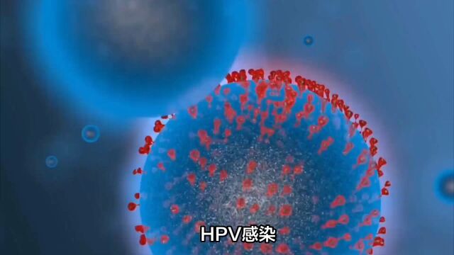 HPV感染如何治疗南京家和医院