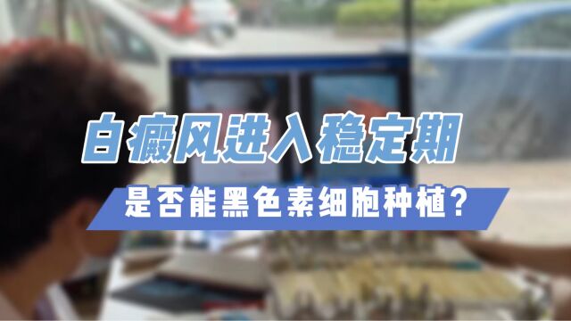 白癜风进入稳定期,是否能黑色素细胞种植?福建省厦门专业治疗白癜风的医院哪家好?