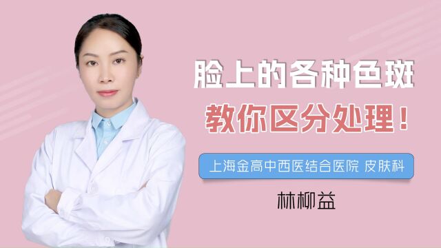 脸上长了各种色斑怎么处理呢?皮肤科医生教你区分处理!#色斑 #黄褐斑 #雀斑 #老年斑 #褐青色痣 #上海金高医院