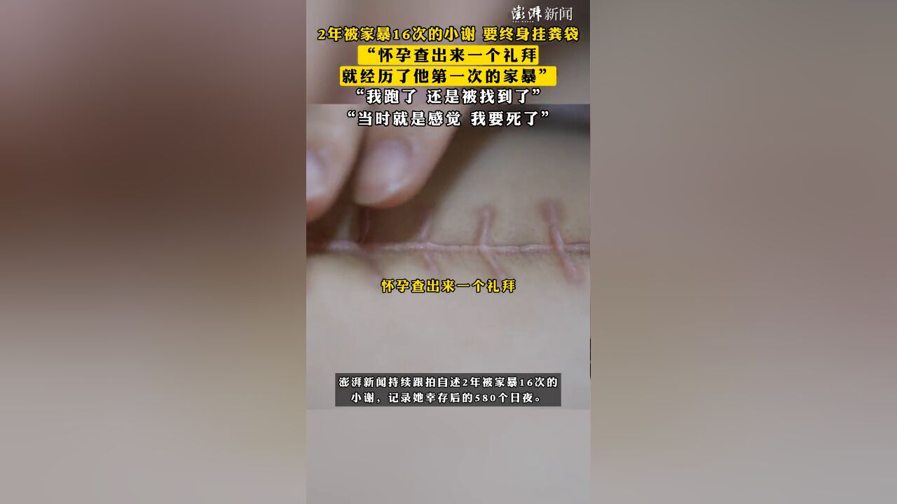 2年被家暴16次的小谢要终身挂粪袋