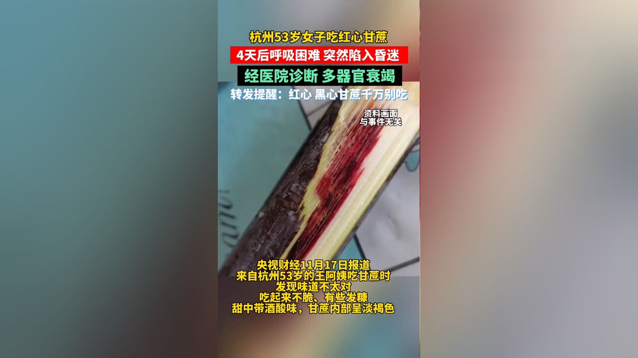 杭州53岁女子吃红心甘蔗,4天后呼吸困难,突然陷入昏迷