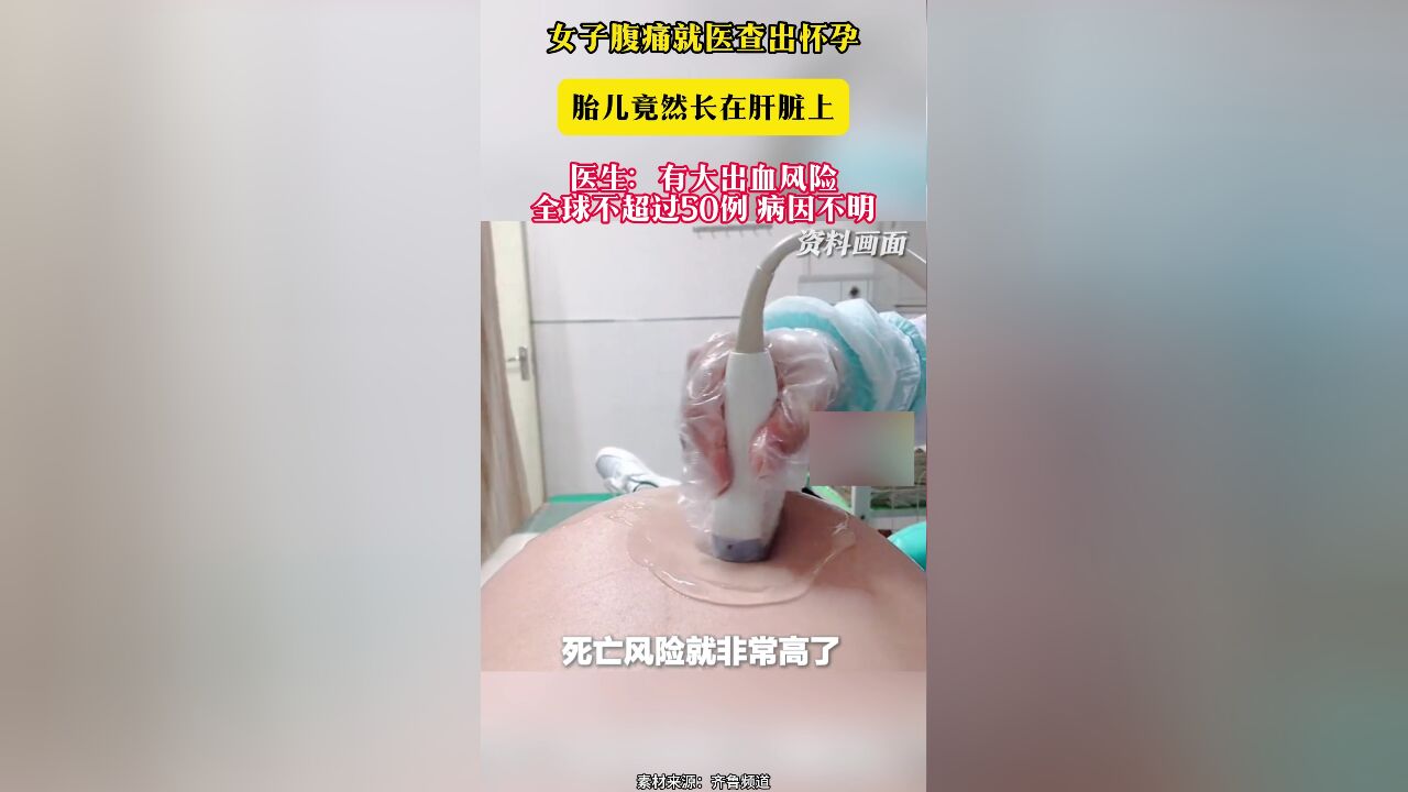 女子腹痛就医查出怀孕 胎儿竟然长在肝脏上 医生:有大出血风险 全球不超过50例 病因不明