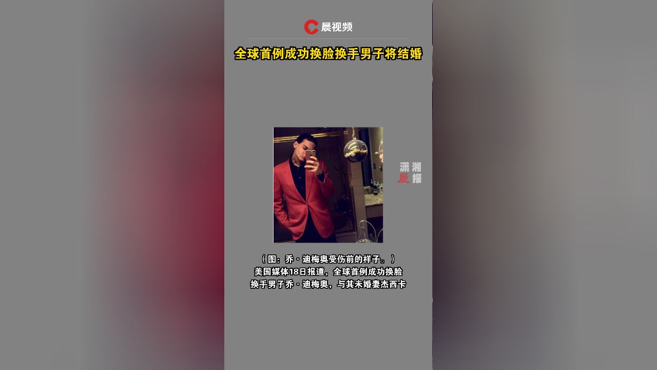 全球首例成功换脸换手男子将结婚