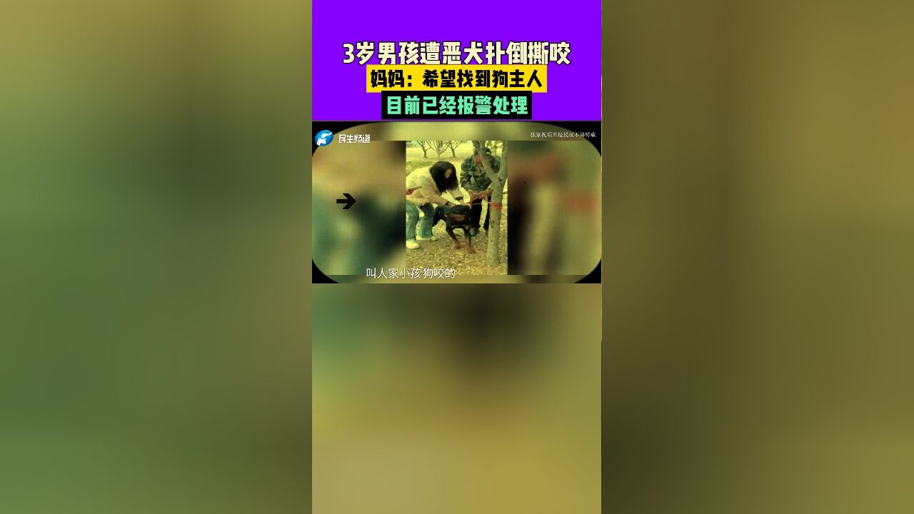 3岁男孩遭恶犬扑倒撕咬,妈妈:希望找到狗主人,目前已经报警处理