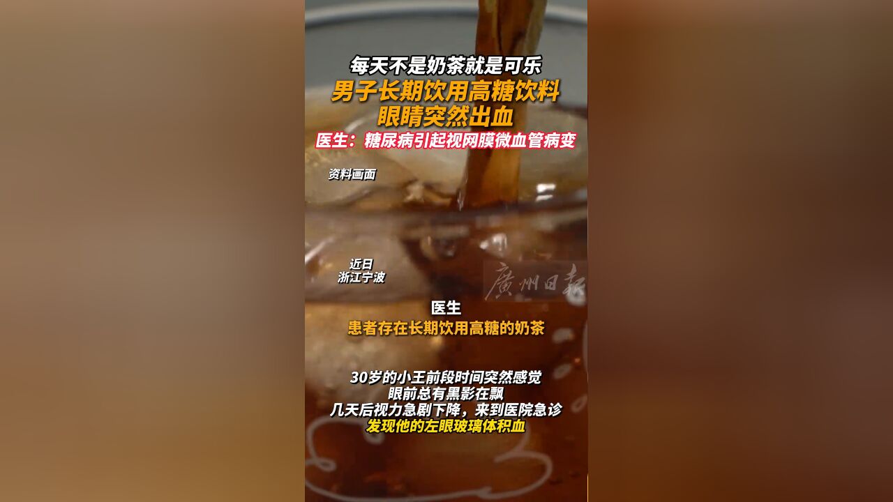 每天不是奶茶就是可乐 男子长期饮用高糖饮料眼睛突然出血