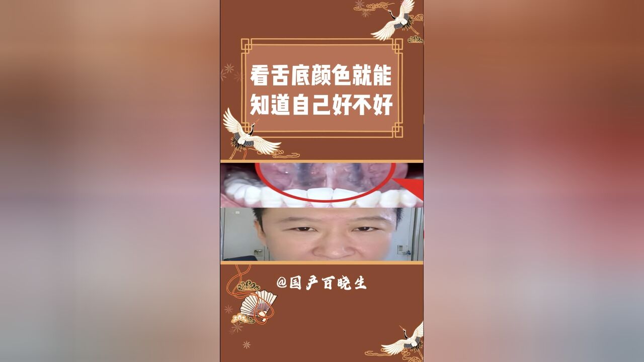 是谁现在照镜子看舌底啊啊! 仅供分享无不良引导