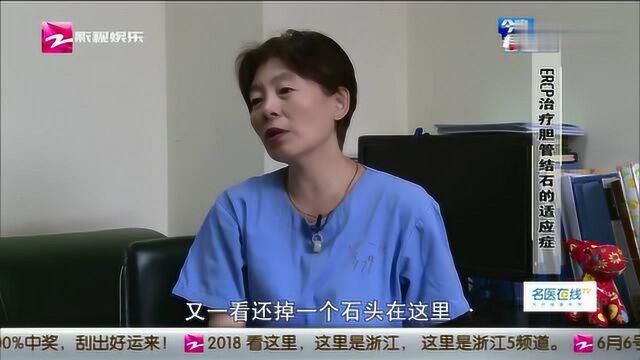 ERCP治疗胆管结石的适应症有哪些