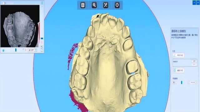 AIS Pro 扫描软件 DentalScan惊艳升级