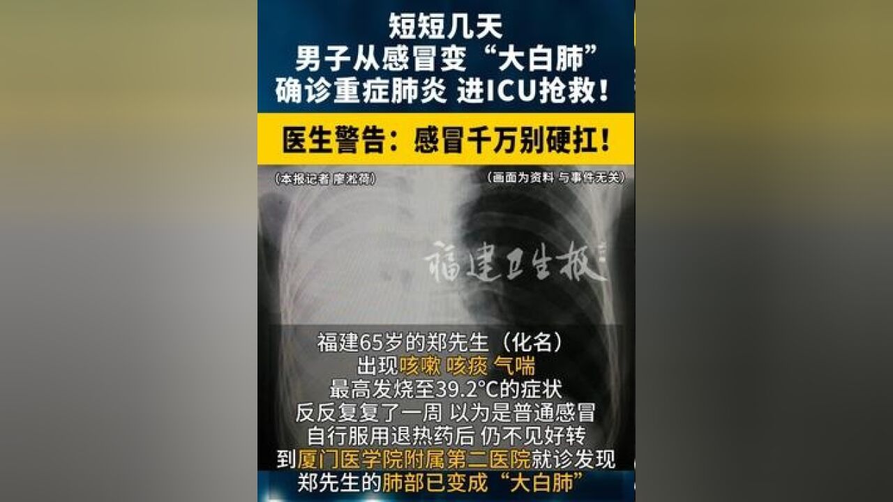 短短几天,男子从感冒变“大白肺 ”,确诊重症肺炎 ,进ICU抢救!医生警告:感冒千万别硬扛!