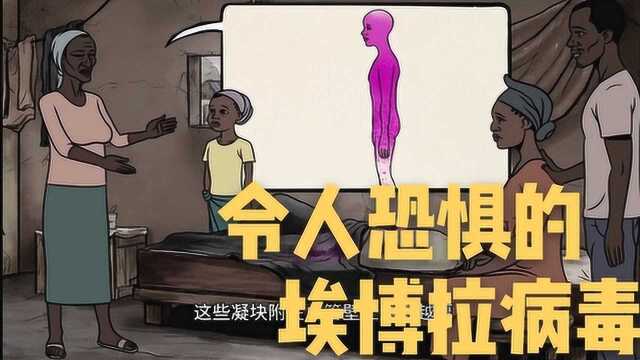 肆虐非洲,致死率高达60%,令人恐惧的埃博拉病毒