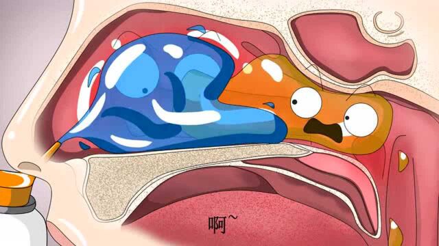 鼻窦炎清洗呛到了