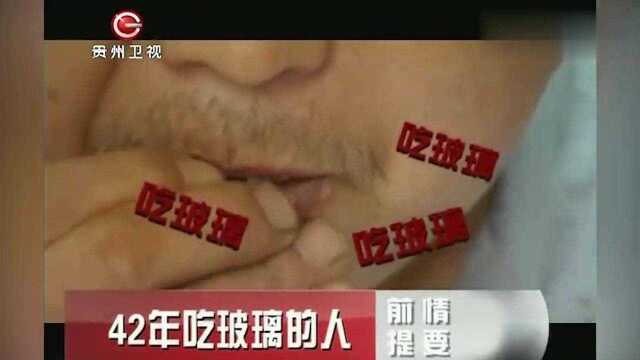 男子十二岁时吃了一口玻璃,从此再也停不下来,每天都要吃灯泡