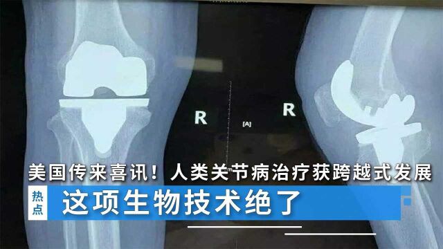 美国传来一大喜讯!人类关节病治疗获跨越式发展,这项生物技术绝了