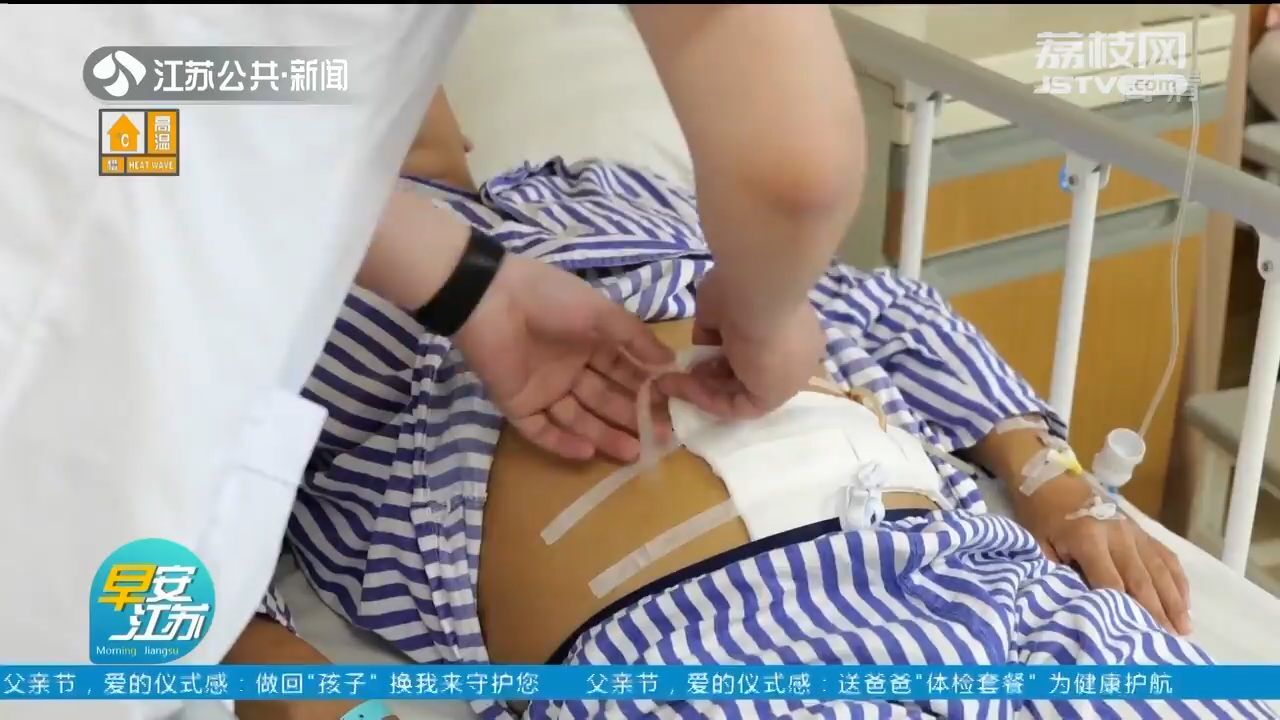 险些丢了性命!常州一男子腹痛难忍 竟是6公分鱼刺“穿腹”