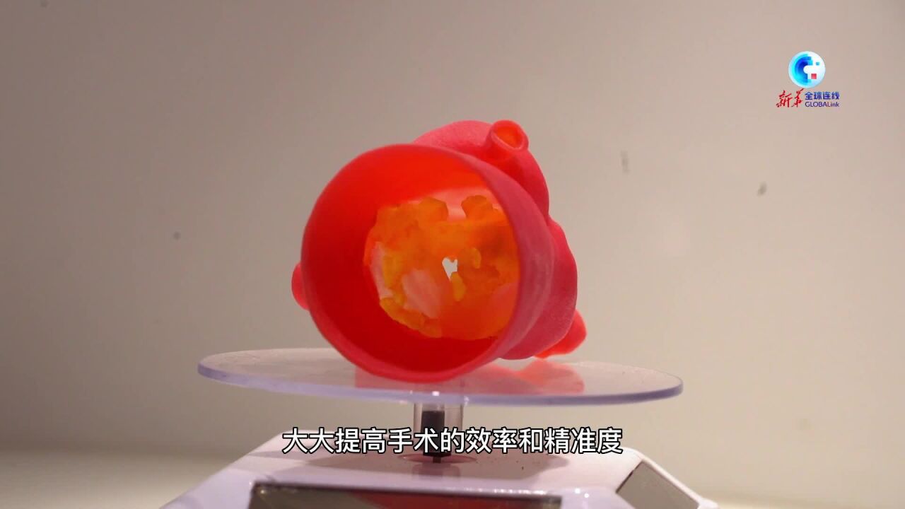 全球连线丨探访医学3D打印中心