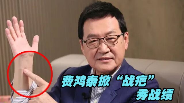 面对徐巧芯挑战,费鸿泰为证明自己有战力,掀“战疤”秀战绩