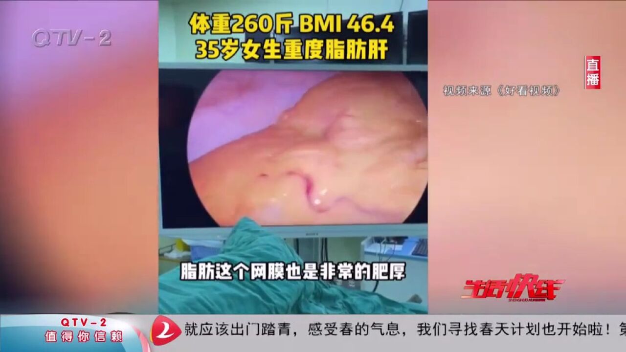 有了脂肪肝,从饮食上应该怎么入手?听听专家怎么说