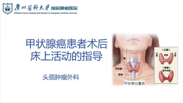 头颈外科甲状腺癌患者术后床上活动的指导