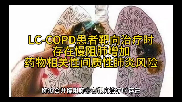 LCCOPD患者靶向治疗时存在慢阻肺增加药物相关性间质性肺炎风险