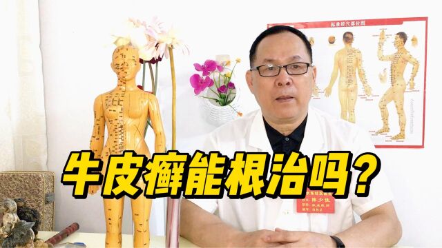 得了牛皮癣瘙痒难忍,这病还能根除吗?医生几十年经验告诉你秘密