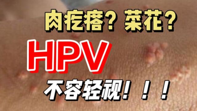 HPV病毒是什么?