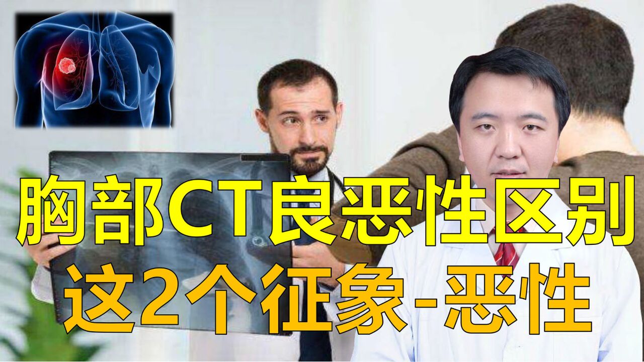 胸部CT如何区别良恶性?这2个征象提示肺癌,需要手术治疗