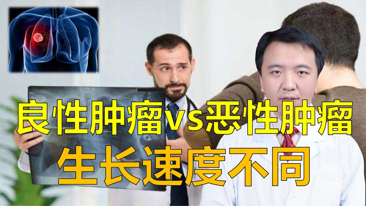 良性肿瘤和恶性肿瘤如何区分?生长速度是重要鉴别点