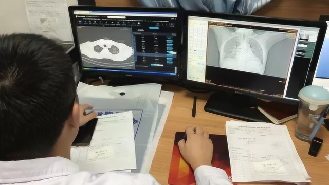 人工智能肺炎辅诊系统 300幅肺部CT影像10秒“搞定”