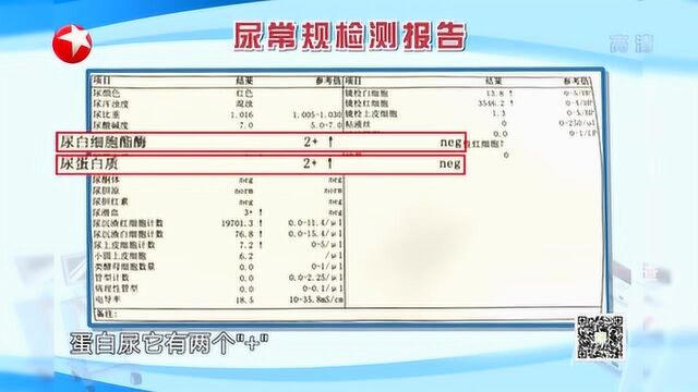 做了尿常规检测,单子上一定要注意这3条,可能患有疾病!