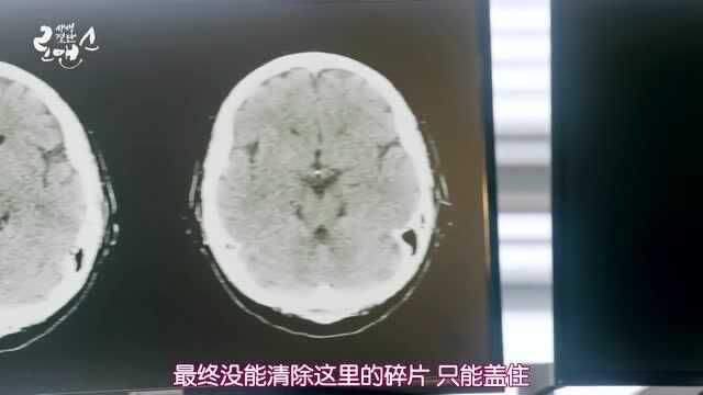 《生死决断罗曼史》池贤宇碎片压血管要避免激动,李诗英问爱情呢