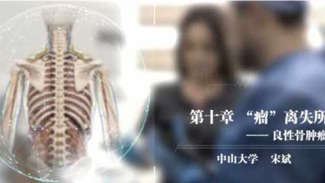 良性骨肿瘤 “瘤”离失所——《骨科学概论》