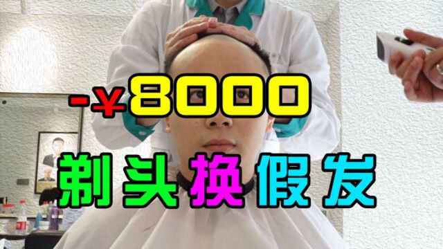 终究还是对我的发际线下手了,花了8000剃掉真发换假发!