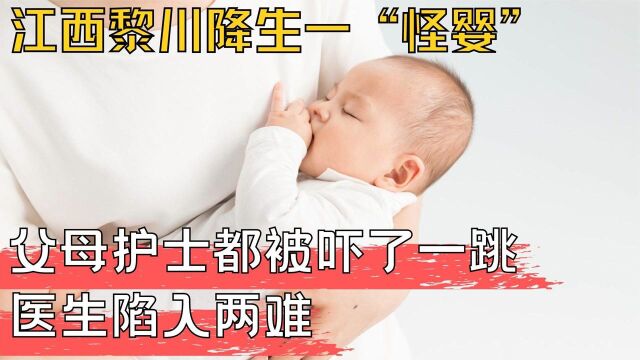 江西诞下一怪婴,医生陷入两难,父母看到后都吓了一跳