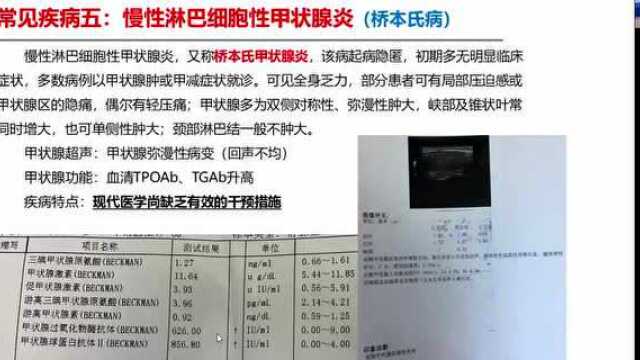 【京津冀协同发展项目医联体建设】甲状腺功能解读及常见疾病介绍——东直门医院通州院区优质医疗资源“动”起来医联体系列活动(十四)