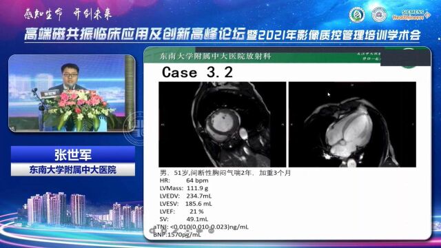 心室扩大的MR诊断中大张世军