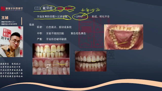 谦谦牙医2023年口腔执业(含助理)医师资格考试——口组